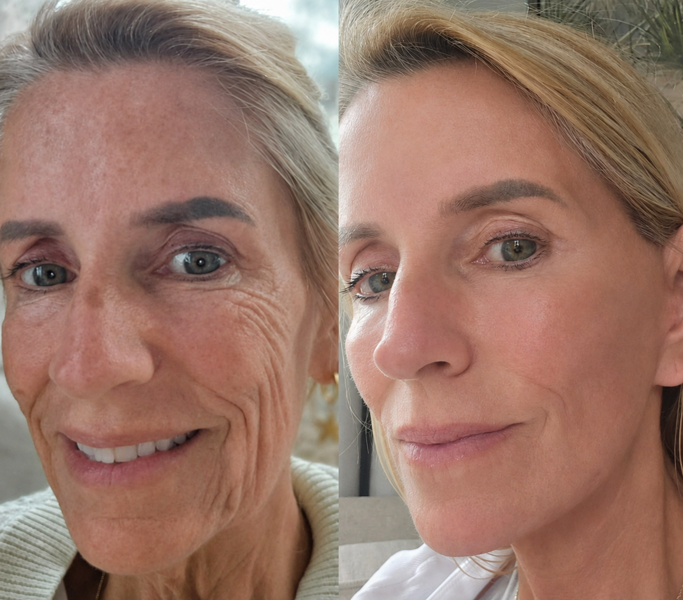 Before and after 3